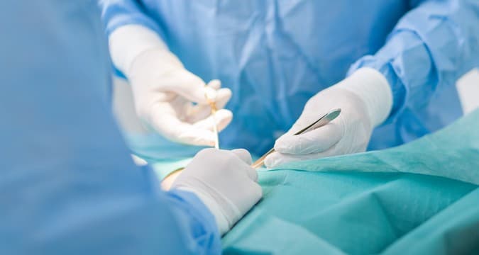 excision surgeon method
